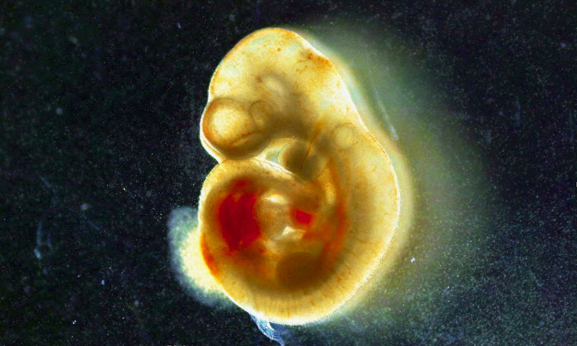 Embryo